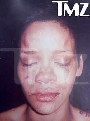 Photo du visage de Rihanna blessée